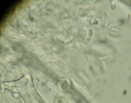 Tubulicrinis? (Tubulicrinis subulatus)